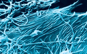 Vaccine dạng xịt mũi giúp phòng ngừa virus Ebola